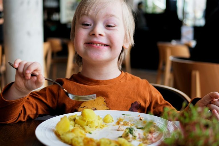 Síndrome de Down Síndrome de Down