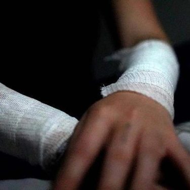 Autolesiones no suicidas en adolescentes