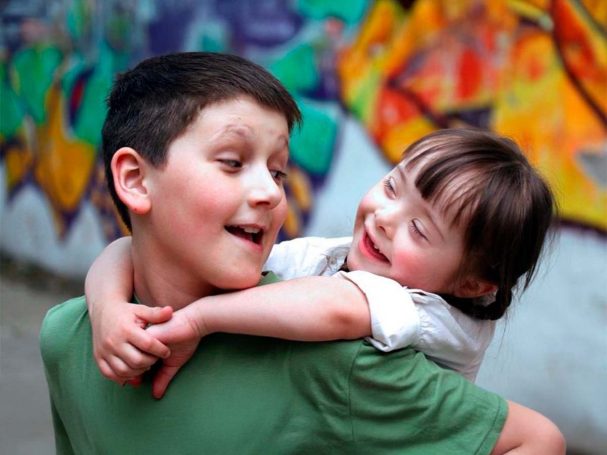 sindrome de down madrid