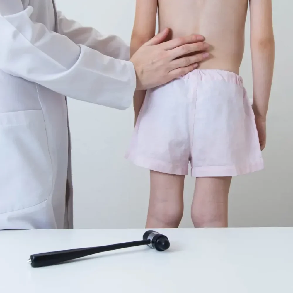 Escoliosis en niños y adolescentes