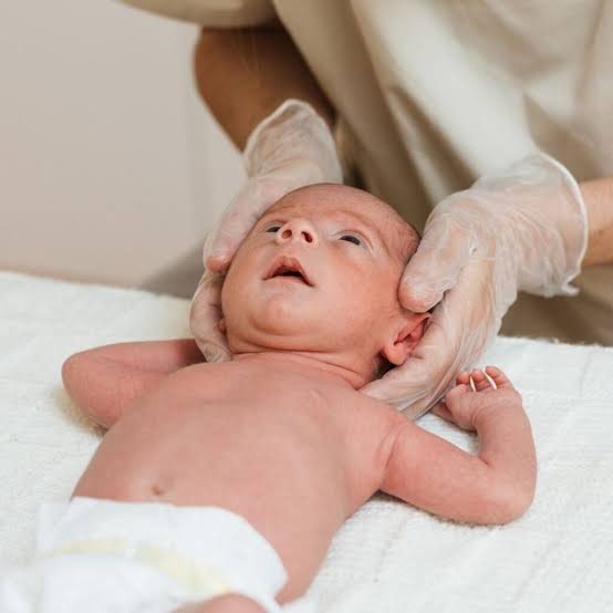 fisioterapia pediátrica en el recién nacido