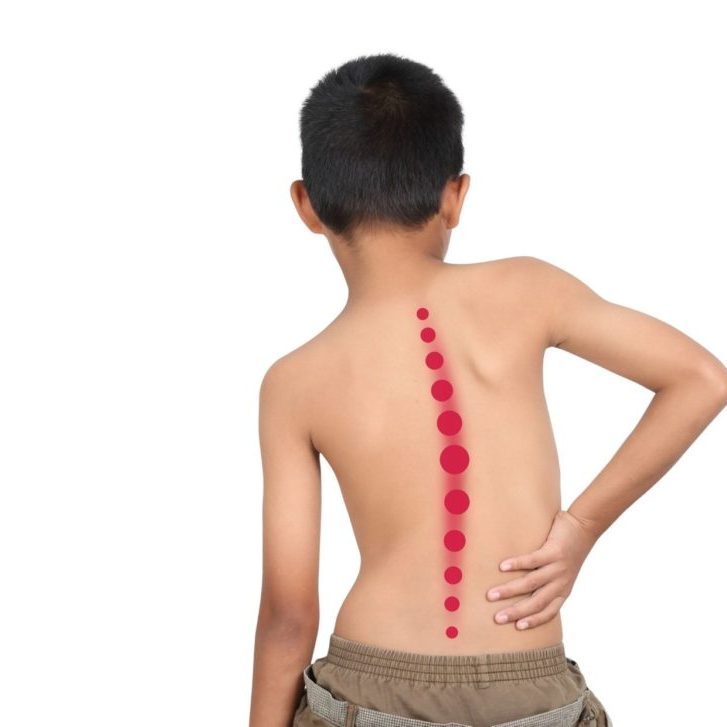 Dolor de rodilla en adolescentes deportistas